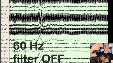 EEG Filters (HFF, LFF, Notch, Artifact)