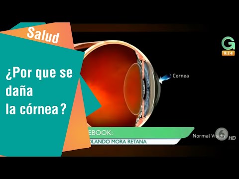 ¿Por qué se daña la córnea y cuáles son sus efectos en nuestra visión? | Salud