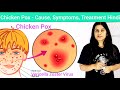 Chicken pox  cause symptoms diagnosis treatment hindi  vericella zoster viruschicken pox hindi