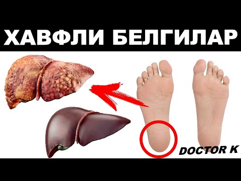 ЖИГАРИНГИЗ КАСАЛ ХАҚИДА ЎТА ХАВФЛИ БЕЛГИЛАР! ОГОХ БЎЛИНГ!!!