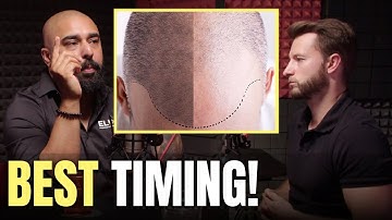 Hair Transplant or Scalp Micro-Pigmentation First?