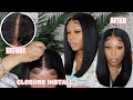 Detailed 5x5 Closure Wig | Bleach, Pluck and Customize Closure Hairline Like A PRO | KlaiyiHair