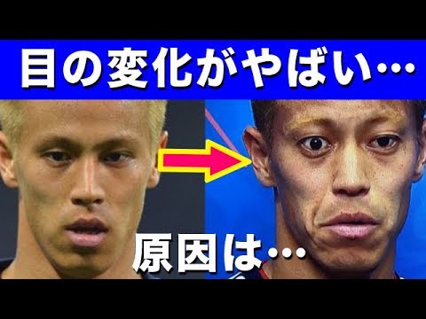 本田圭佑の 目 がおかしい バセドウ病と決して認めず日本代表のエースとして結果を出す男の姿が泣ける セネガル戦で乾とともにゴールを決める ロシアw杯 Youtube