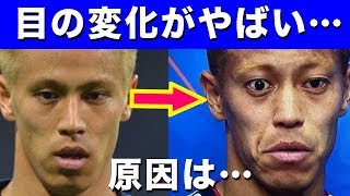 本田圭佑の 目 がおかしい バセドウ病と決して認めず日本代表のエースとして結果を出す男の姿が泣ける セネガル戦で乾とともにゴールを決める ロシアw杯 Yu Yurara