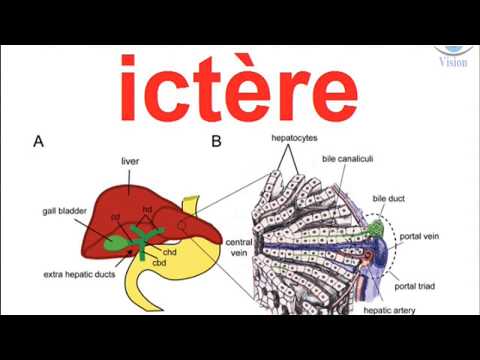 Vidéo: Ictère Obstructif - Causes, Symptômes, Diagnostic Et Traitement