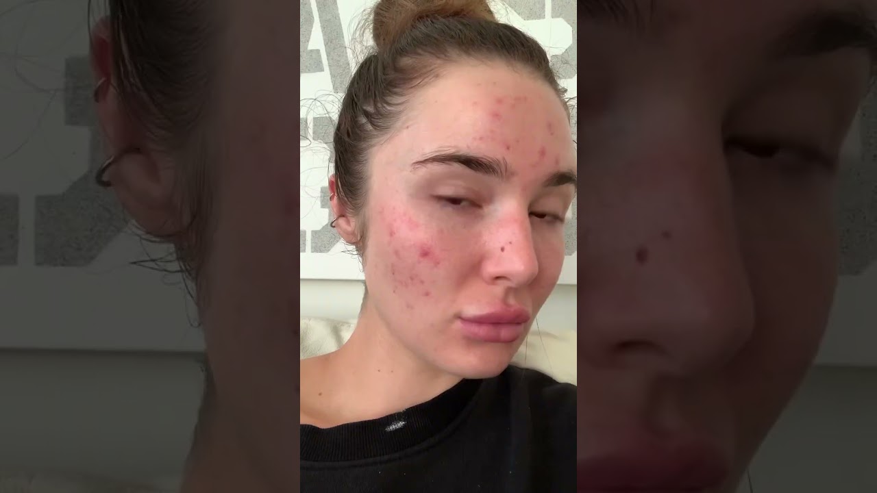 Patience allows healing 🤎 