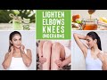 Brighten Dark Patches on Elbows &amp; Knees &amp; Underarms | Home Remedies To Reduce Pigmentation