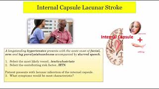 12DaysinMarch, Stroke Localization (Lacunar Infarcts), Part 2 of 3 for the USMLE Step One Exam screenshot 2