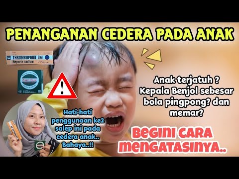 Cara Mengobati Luka Memar pada Anak di Rumah