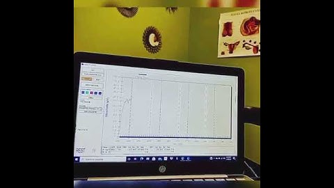 Our Biofeedback technology!