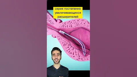 расширение уретры при стриктуре уретры