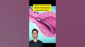 расширение уретры при стриктуре уретры