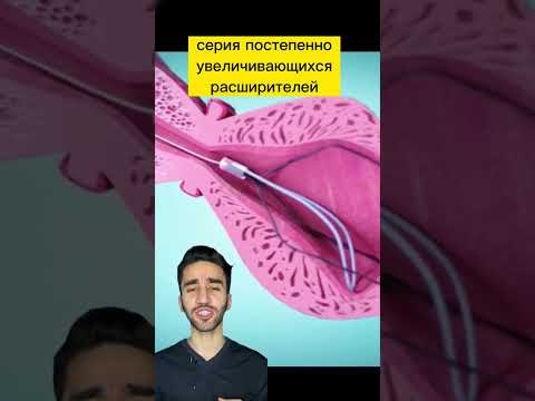 Видео: Насколько широка уретра?