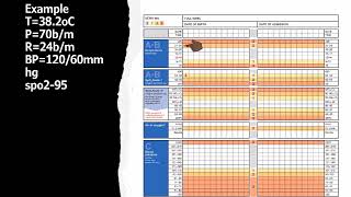 NMC OSCE ASSESSMENT / How To Chart NEWS2 / Nursing Diagnosis for News2