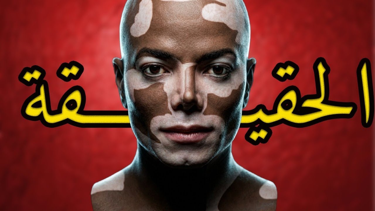 ماهو السر الذي اخفاه مايكل عن الجميع طيل حياته !!