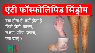 Anti Phospholipids syndrome in hindi | एंटी फॉस्फोलिपिड सिंड्रोम किसे क्यों क्या कैसे होता है,