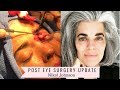 Post Surgery Update | Plastic Surgery | Nikol Johnson