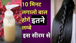 10 मिनट लगाया और बाल 10 दिन में 15 इंच बाल लंबे हो गए | long hair grow | बाल कभी नहीं झडेंगे | hair