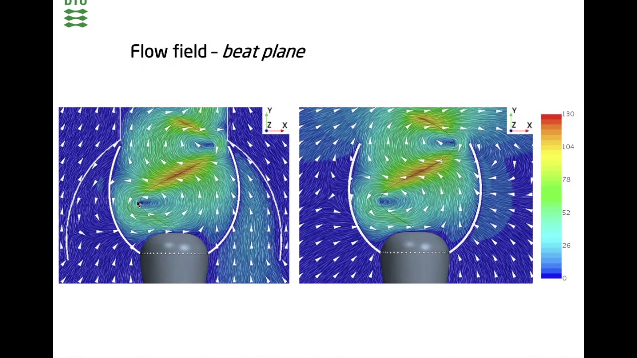 Hydrodynamics of prey capture and transportation in choanoflagellates