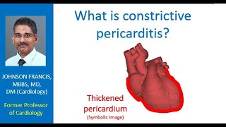 What is constrictive pericarditis?