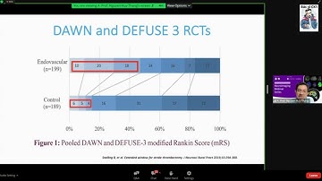 Nhồi máu não - Cập nhật can thiệp lấy huyết khối 2023 - PGs. Ts. Bs.  Nguyễn Huy Thắng
