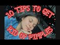 HOW TO GET RID OF PIMPLES | TIP TUESDAY | HELLEN GOMEZ