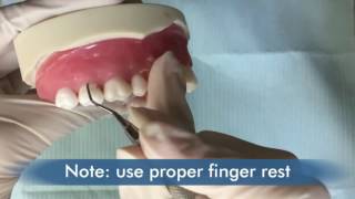 Dentiscope How To Use Subgingival Scalers