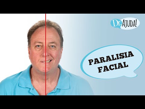 PARALISIA FACIAL: O QUE É, SINTOMAS, DIAGNÓSTICO, CAUSAS E TRATAMENTO