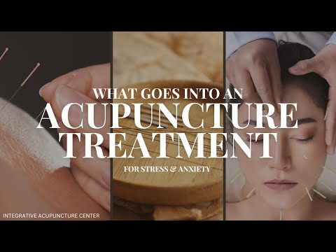 What Goes into an Acupuncture Treatment for Patients with Stress and Anxiety