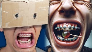 Watch This If Your Braces HURT!