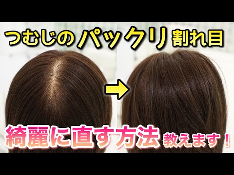 これで直ります つむじ 分け目のパックリ割れ Youtube