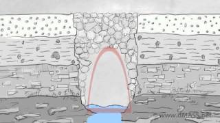 Brief Introduction to Bridges