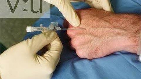 Intravaneous (नसों में) injection kaise lagate hain?What is Proper Intravaneous injecton Angle?