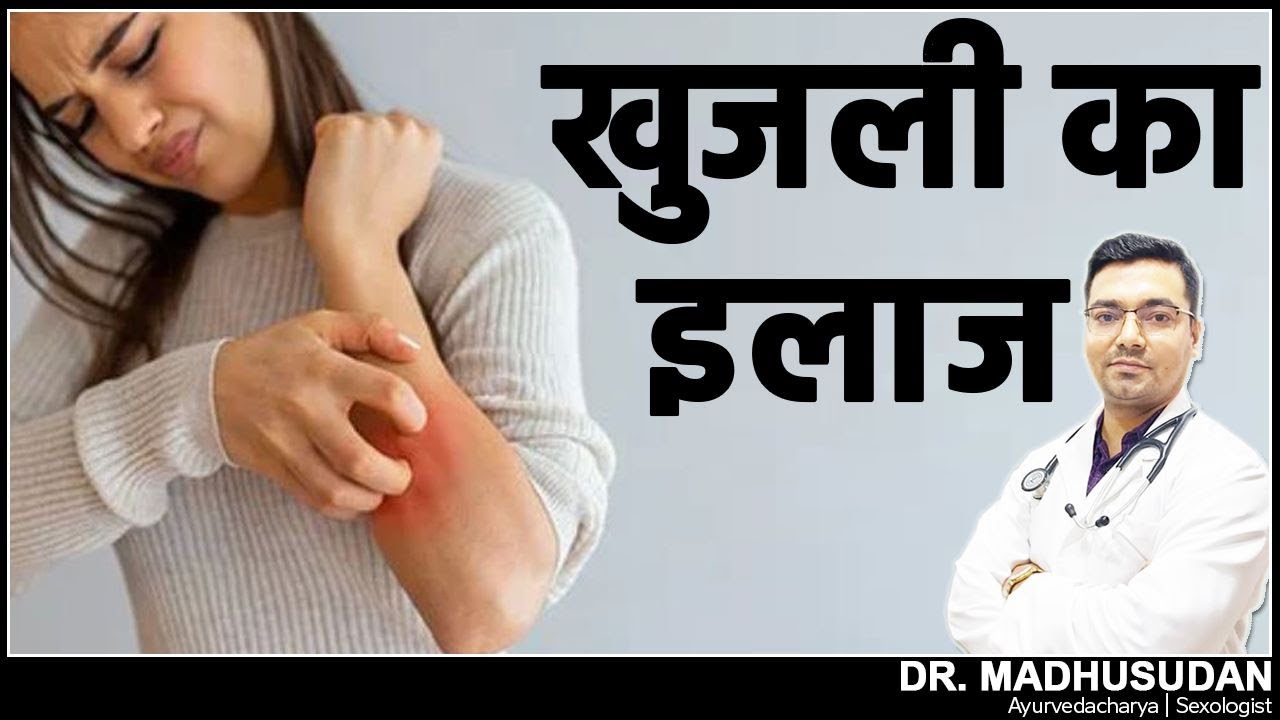 खुजली का इलाज ! Itching Skin Treatment Dr. Madhusudan YouTube