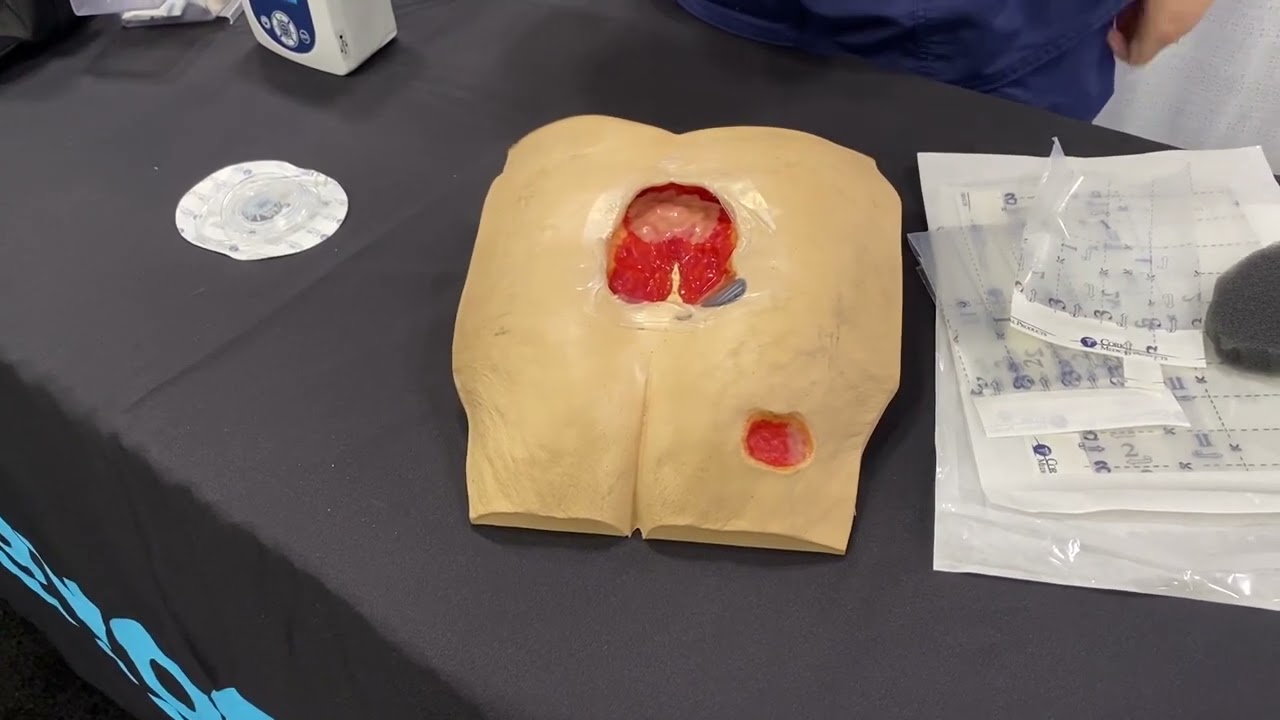 NISUS NPWT PUMP  -  Basic Application