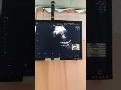 第38週