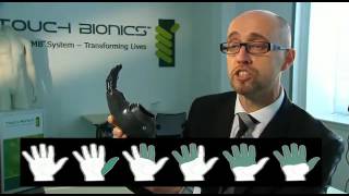손목용 전자의수 ProDigits The world's first bionic finger