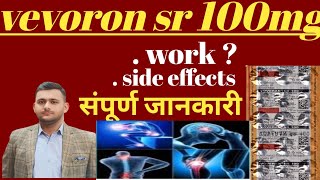 Voveran sr 100 tablet complete review #painkiller