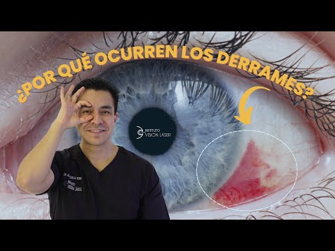 ¿POR QUÉ OCURREN