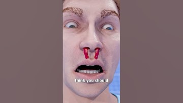 What To Do If You Get A Nosebleed 🤔 Surgeon Reacts