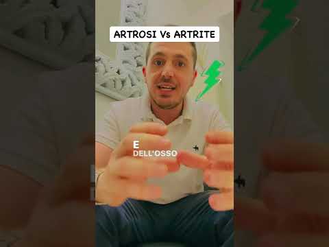 Differenza tra artrosi