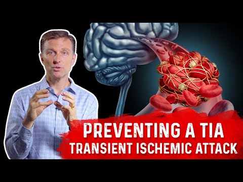 Preventing a Mini-Stroke -TIA (Transient Ischemic Attack)