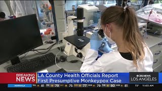 LA County reports first presumptive case of monkeypox