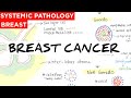 Breast Cancer - Anatomy | causes | classification | Treatment | staging | prognostic & Risk factors