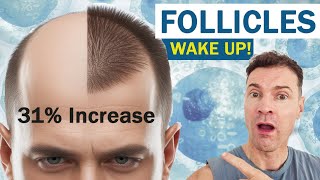 Hair Loss BREAKTHROUGH: PP405 Wakes Up Dead Hair Follicles!