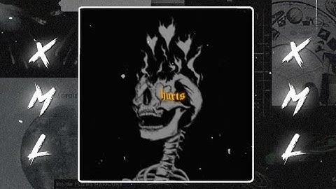 My heart hurts   xml