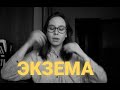 ЭКЗЕМА (мой опыт)