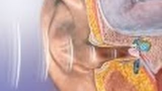 Anatomy and Physiology of Hearing