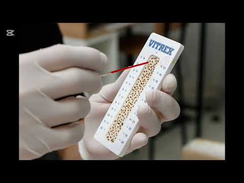 فحص مكداس الدم  الهيماتوکریت   أو ما يسمى ب    واختصاره 