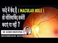 Cataract with macular hole, Cataract surgery with retinal hole #suneyecafe #retinalhole #cataract